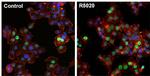 Progesterone Receptor Antibody in Immunocytochemistry (ICC/IF)