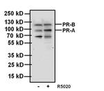 Progesterone Receptor Antibody in Western Blot (WB)