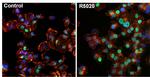 Progesterone Receptor Antibody in Immunocytochemistry (ICC/IF)