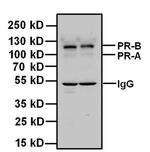 Progesterone Receptor Antibody in Western Blot (WB)