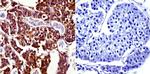 Prolactin Receptor Antibody in Immunohistochemistry (Paraffin) (IHC (P))