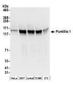 Pumilio 1 Antibody in Western Blot (WB)