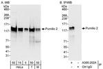 Pumilio 2 Antibody in Western Blot (WB)