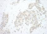 Pygo2 Antibody in Immunohistochemistry (IHC)