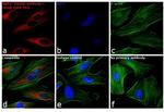 Rabbit IgG (H+L) Secondary Antibody in Immunocytochemistry (ICC/IF)