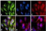 Rabbit IgG (H+L) Secondary Antibody in Immunocytochemistry (ICC/IF)