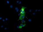 QPRT Antibody in Immunocytochemistry (ICC/IF)