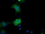 QPRT Antibody in Immunocytochemistry (ICC/IF)