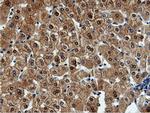 QPRT Antibody in Immunohistochemistry (Paraffin) (IHC (P))