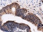 QPRT Antibody in Immunohistochemistry (Paraffin) (IHC (P))