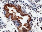 QPRT Antibody in Immunohistochemistry (Paraffin) (IHC (P))