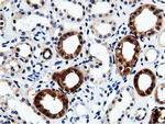 QPRT Antibody in Immunohistochemistry (Paraffin) (IHC (P))