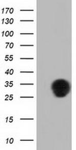 QPRT Antibody in Western Blot (WB)