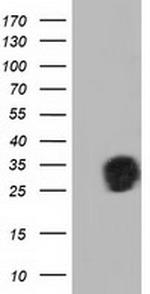 QPRT Antibody in Western Blot (WB)