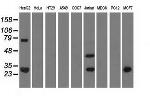 QPRT Antibody in Western Blot (WB)