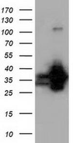 QPRT Antibody in Western Blot (WB)