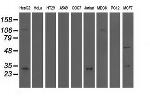 QPRT Antibody in Western Blot (WB)