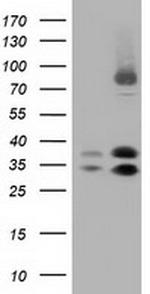 QPRT Antibody in Western Blot (WB)