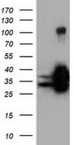 QPRT Antibody in Western Blot (WB)
