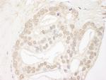 QSER1 Antibody in Immunohistochemistry (IHC)