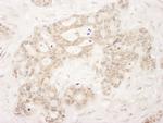 QSER1 Antibody in Immunohistochemistry (IHC)