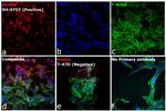 Mouse IgG (H+L) Cross-Adsorbed Secondary Antibody in Immunocytochemistry (ICC/IF)