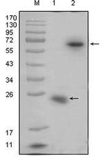 RSPO1 Antibody in Western Blot (WB)