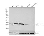 beta-2 Microglobulin Antibody