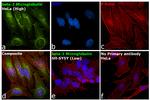 beta-2 Microglobulin Antibody in Immunocytochemistry (ICC/IF)