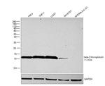 beta-2 Microglobulin Antibody in Western Blot (WB)