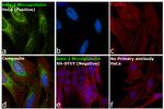 beta-2 Microglobulin Antibody in Immunocytochemistry (ICC/IF)