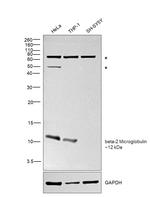 beta-2 Microglobulin Antibody in Western Blot (WB)