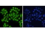 Histone H3 (di-methyl K4) Antibody in Immunocytochemistry (ICC/IF)