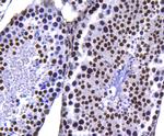 Histone H3 (di-methyl K4) Antibody in Immunohistochemistry (Paraffin) (IHC (P))