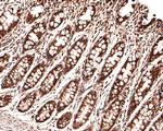 KLF4 Antibody in Immunohistochemistry (Paraffin) (IHC (P))