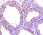 EEA1 Antibody in Immunohistochemistry (Paraffin) (IHC (P))