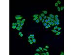 ALDH2 Antibody in Immunocytochemistry (ICC/IF)