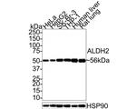 ALDH2 Antibody in Western Blot (WB)