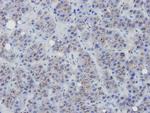 eNOS Antibody in Immunohistochemistry (Paraffin) (IHC (P))