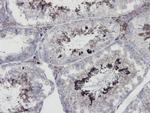 eNOS Antibody in Immunohistochemistry (Paraffin) (IHC (P))