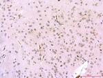 PSD95 Antibody in Immunohistochemistry (Paraffin) (IHC (P))