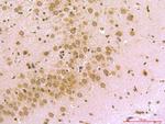 PSD95 Antibody in Immunohistochemistry (Paraffin) (IHC (P))