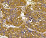 BMPR1A Antibody in Immunohistochemistry (Paraffin) (IHC (P))