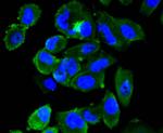 FPR2 Antibody in Immunocytochemistry (ICC/IF)