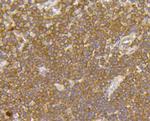 FPR2 Antibody in Immunohistochemistry (Paraffin) (IHC (P))