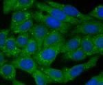 mTOR Antibody in Immunocytochemistry (ICC/IF)