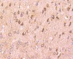 mTOR Antibody in Immunohistochemistry (Paraffin) (IHC (P))