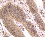 SMAD3 Antibody in Immunohistochemistry (Paraffin) (IHC (P))