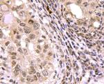 SMAD3 Antibody in Immunohistochemistry (Paraffin) (IHC (P))