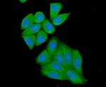 nNOS Antibody in Immunocytochemistry (ICC/IF)